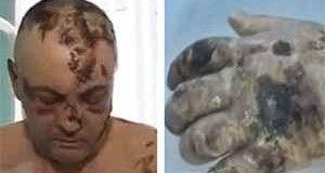 Krokodil