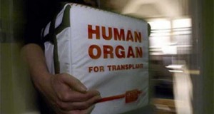 organ transplant