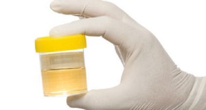 Drug test