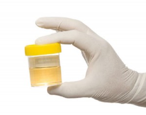 Drug test